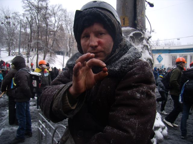 Чергова жертва обстрілу «Беркуту» із власне трофеєм-гумовою кулею власноруч витягнутою із свого обличчя